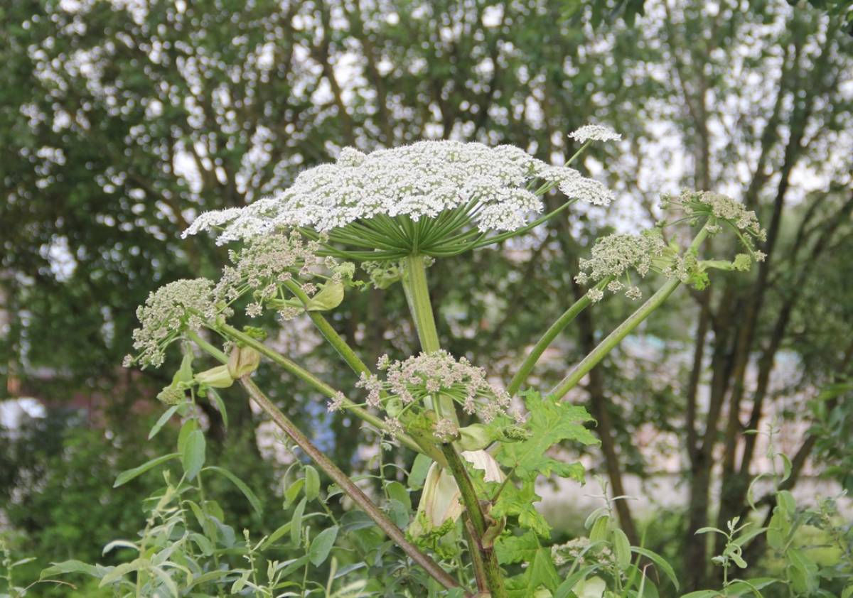 Следком разбирается в истории с пострадавшими от борщевика юными пестовчанами
